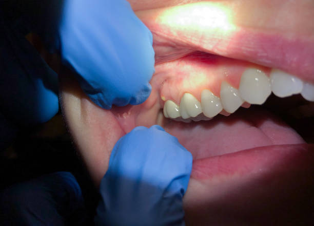 Best Emergency Dentist for Knocked-Out Tooth in Banks, OR
